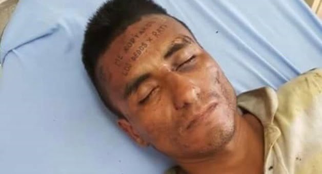 Intenta robar y le cortan los dedos