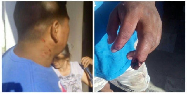 Lo atacan a machetazos y con bates de béisbol