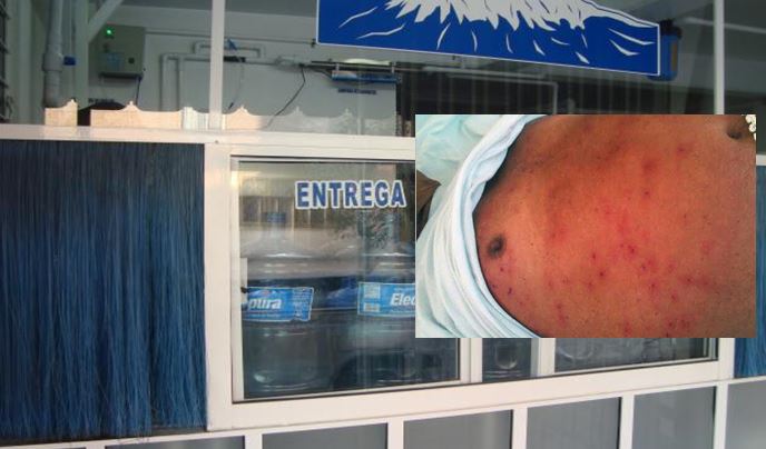 Empleado de purificadora hospitalizado por ataque de abejas