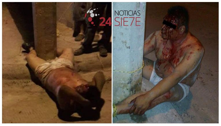 Presunto violador se reporta fuera de peligro en hospital