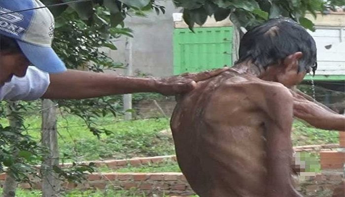 Muere víctima de agresiones y encierro por parte de su hijo