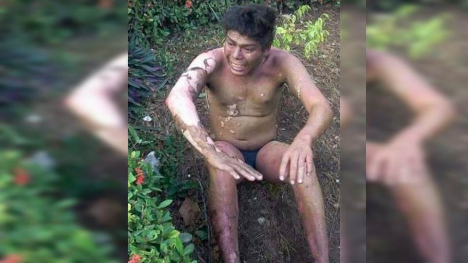 Muere hombre al que le prendieron fuego