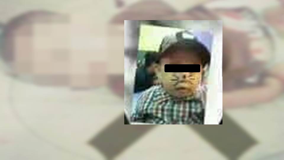 Fallece bebé tras tomar ácido muriático