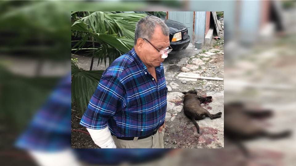 Pitbull ataca y deja grave a niña de un año