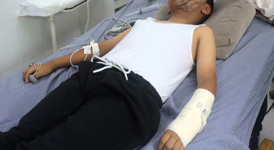 Golpean a su compañero y le provocan fractura de brazo
