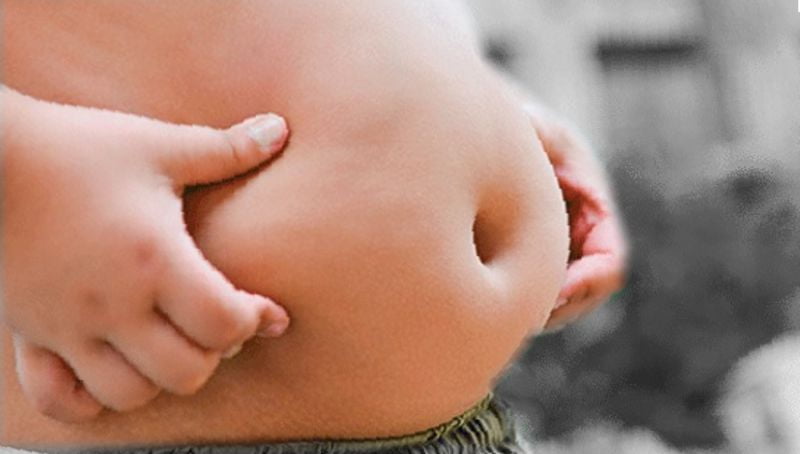 Existen 26 mil niños con obesidad en Nuevo Laredo