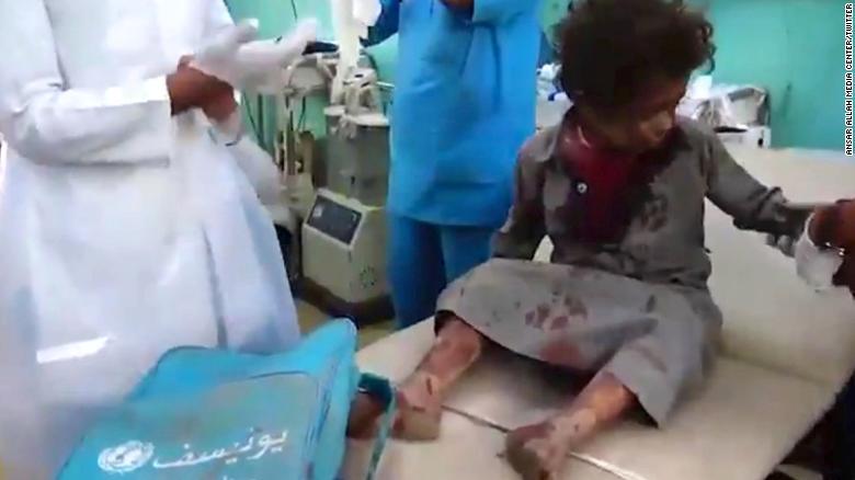 39 niños muertos en ataque contra un autobús escolar en Yemen
