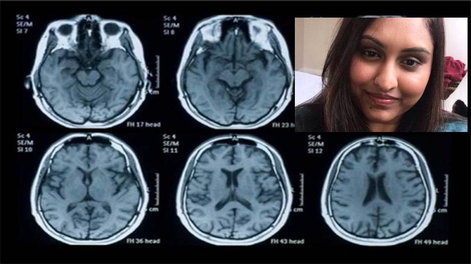 Fingió tener cáncer y estafó a medio mundo; le dan 4 años de cárcel