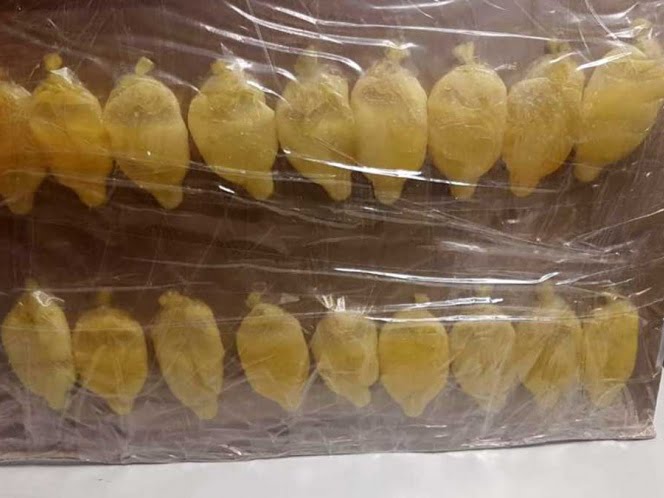 Le dolía el estómago en el aeropuerto, y le sacaron 40 bolsas con cocaína