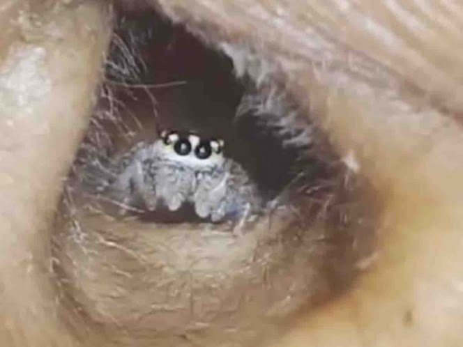 Va al médico por dolor de cabeza; tenía horrible araña dentro