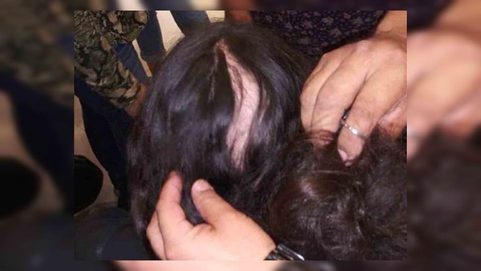 Sillón de masajes falla y arranca cabello a niña en Sinaloa