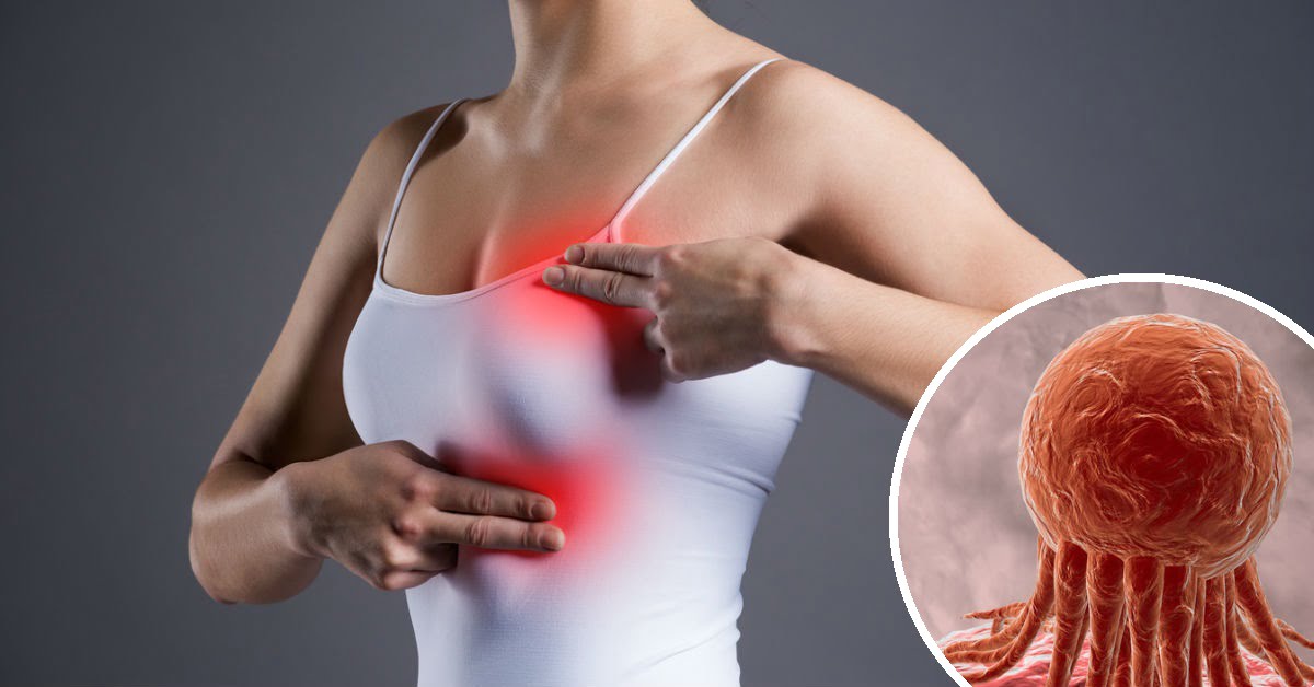Crean vacuna contra cáncer de mama y ya curaron a una paciente