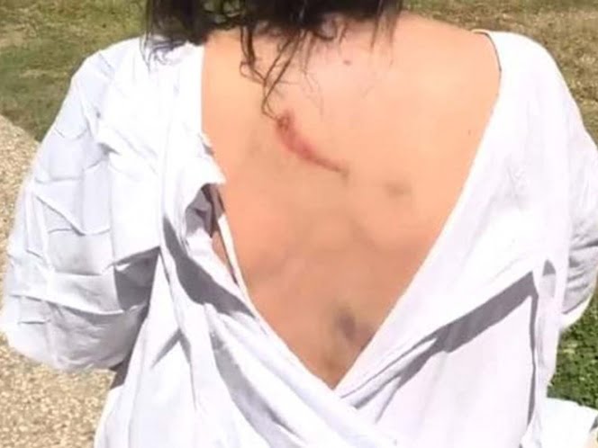 Sacó a pasear a su perro y un canguro los atacó; le destrozó la cara