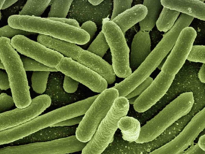 Aumentan en casi 30 por ciento casos de brucelosis en México