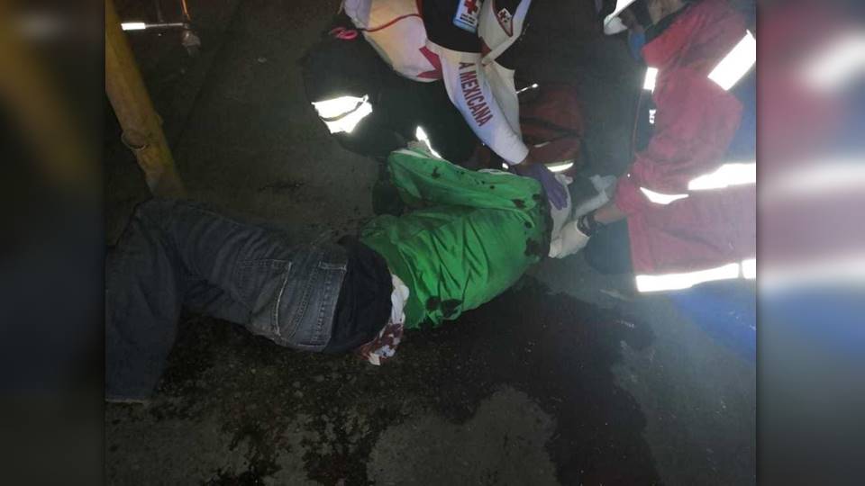 Cae de automóvil y se le desprende el cuero cabelludo en Tampico