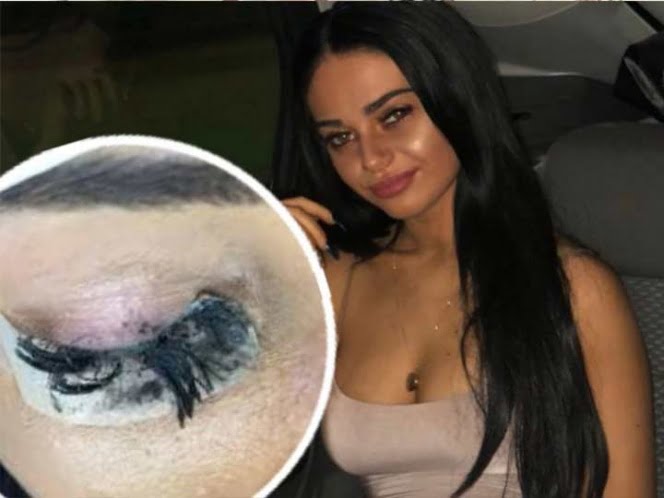 Fue por extensiones de pestañas y terminó con los ojos pegados