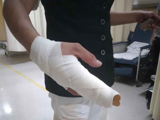 Niños golpean a enfermera por miedo al coronavirus