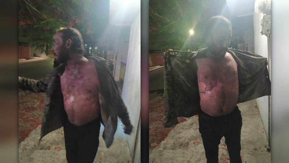 Sujetos le prenden fuego a indigente en Ciudad Madero y se dan a la fuga