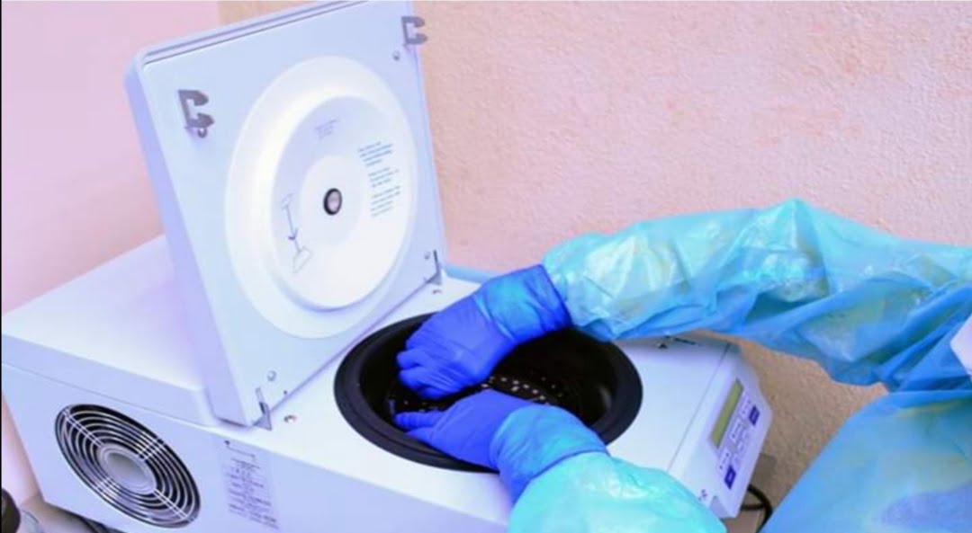 Diagnostican 64 nuevos casos de COVID-19 en Tamaulipas, suman 2 mil 449