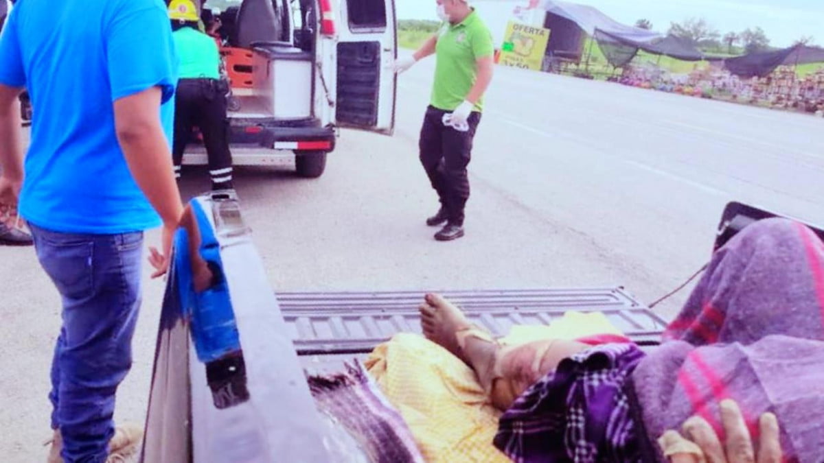 Por arranque de celos le prende fuego a su esposo cuando estaba dormido