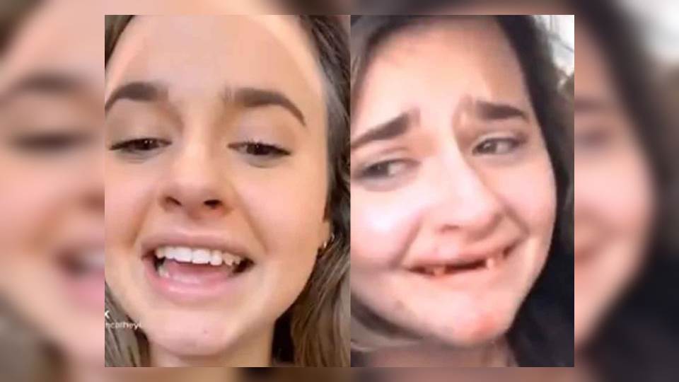 Chica se emborracha  y termina sin dientes por hacer video de TikTok