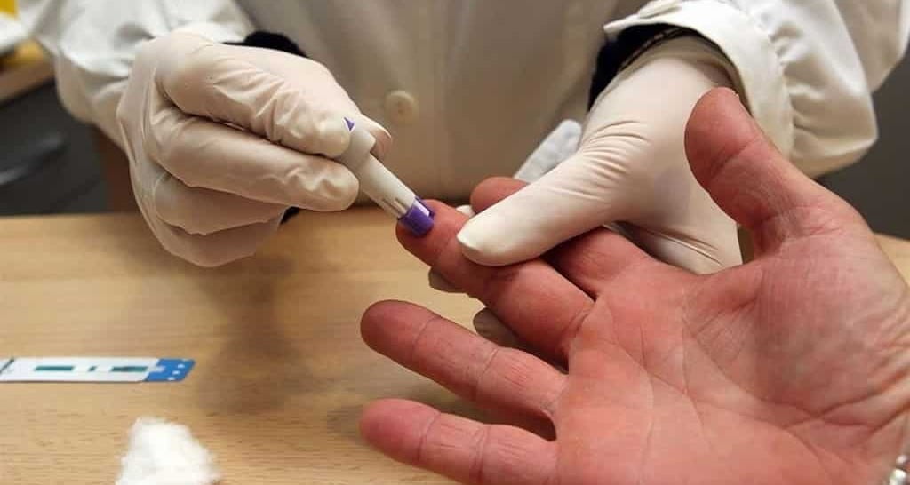 Hombres encabezan cifras en casos de VIH en Tamaulipas 