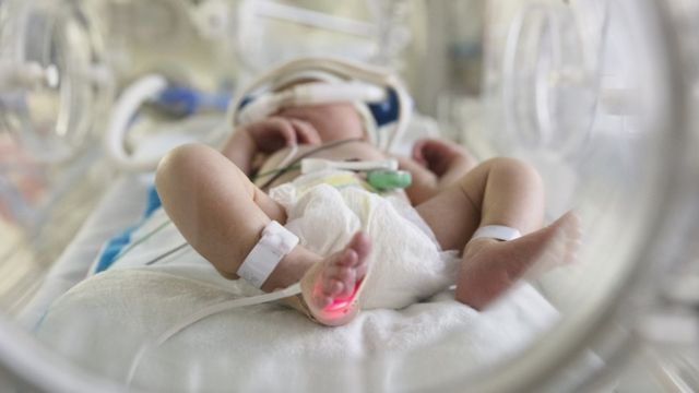 Covid fue más letal con los recién nacidos;169 muertos tenían 0 meses