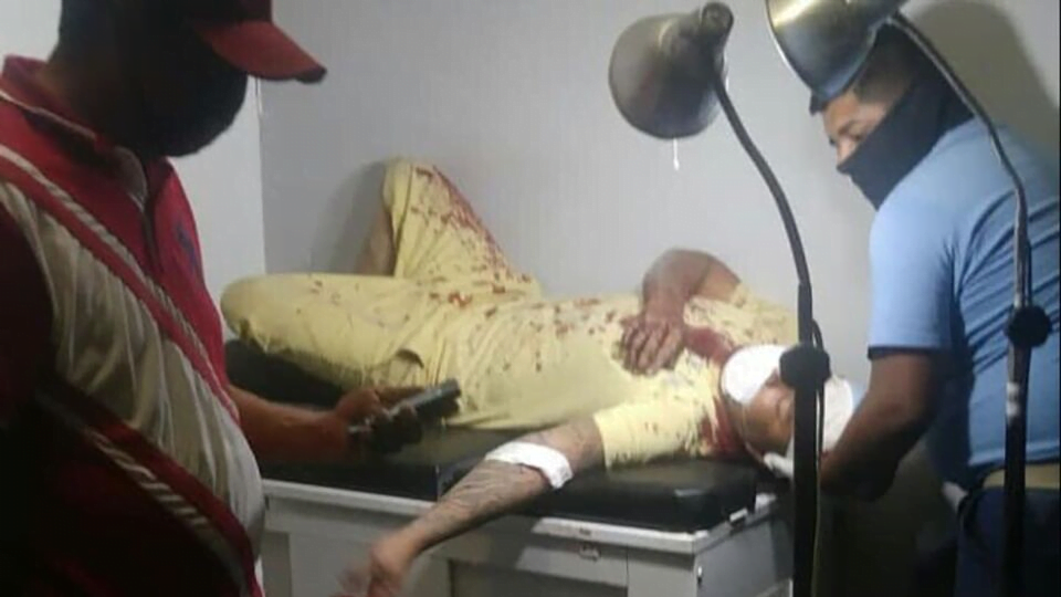 Le clavan navaja en el cráneo, tras ser asaltado en Matamoros
