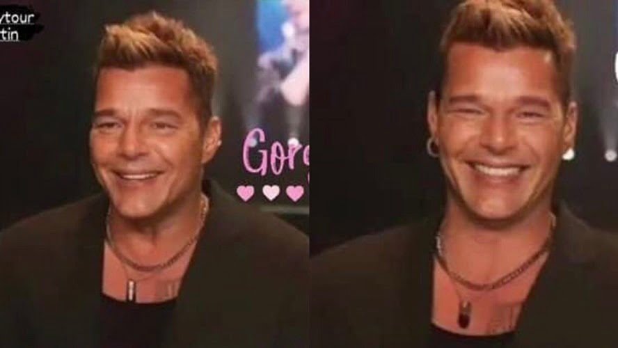 Ricky Martin se vuelve viral en redes por su operación facial
