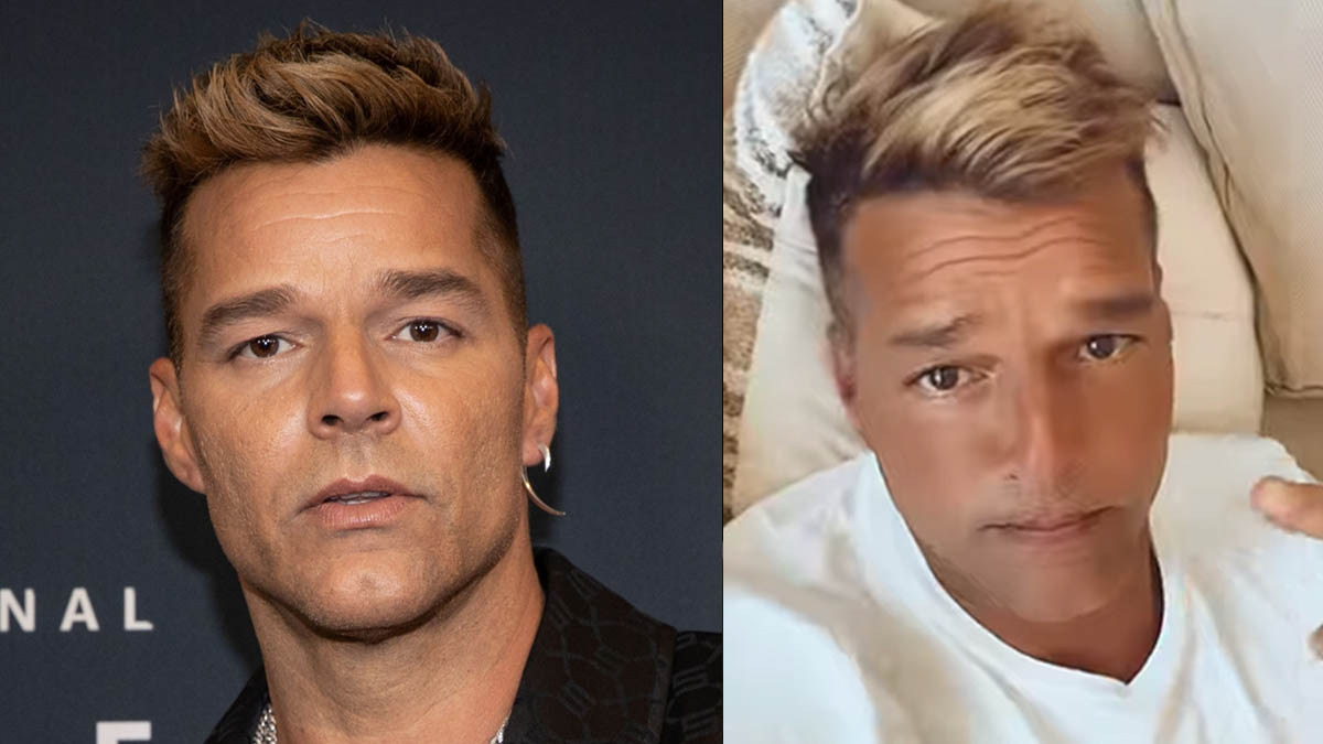 Ricky Martin responde tras polémica por su cambio de cara; dice que no fue cirugía