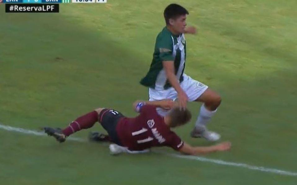 Futbolista sufre aparatosa lesión tras choque accidental