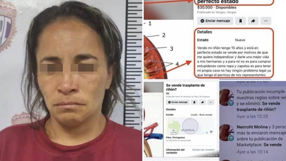 Mujer es detenida tras vender un riñón en redes sociales por 20 mil dólares