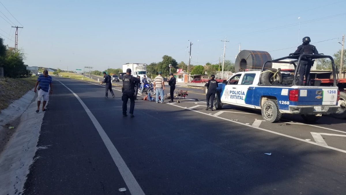 Hombre termina con fractura en su pierna tras accidente