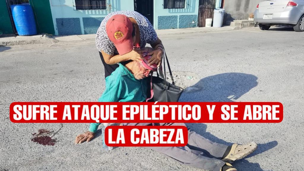 Se abre la cabeza abuelito al sufrir ataque epiléptico