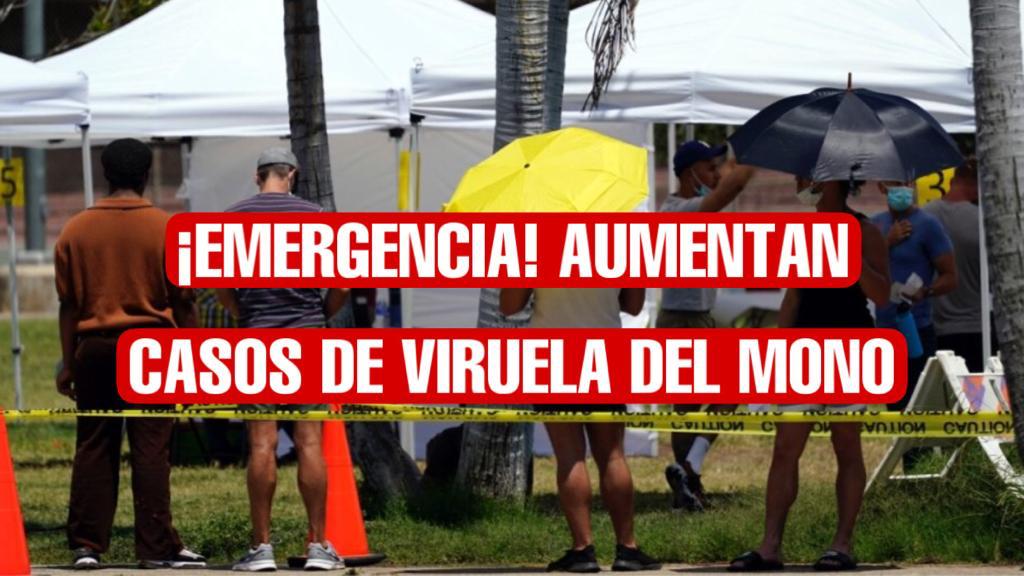 Declaran California e Illinois estado de emergencia tras aumentar casos de viruela del mono