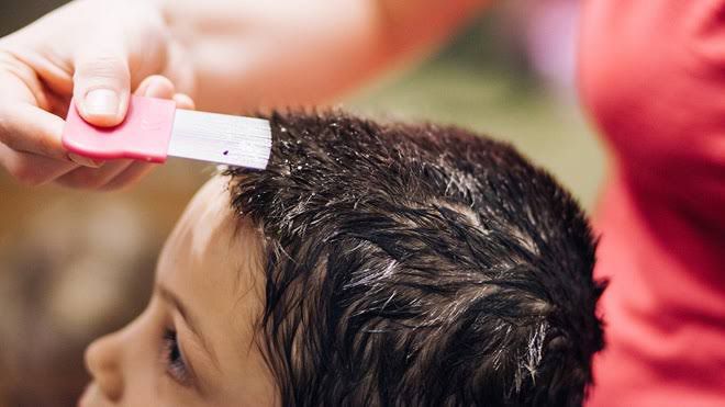 Urge tratar pediculosis en escuelas primarias de Nuevo Laredo