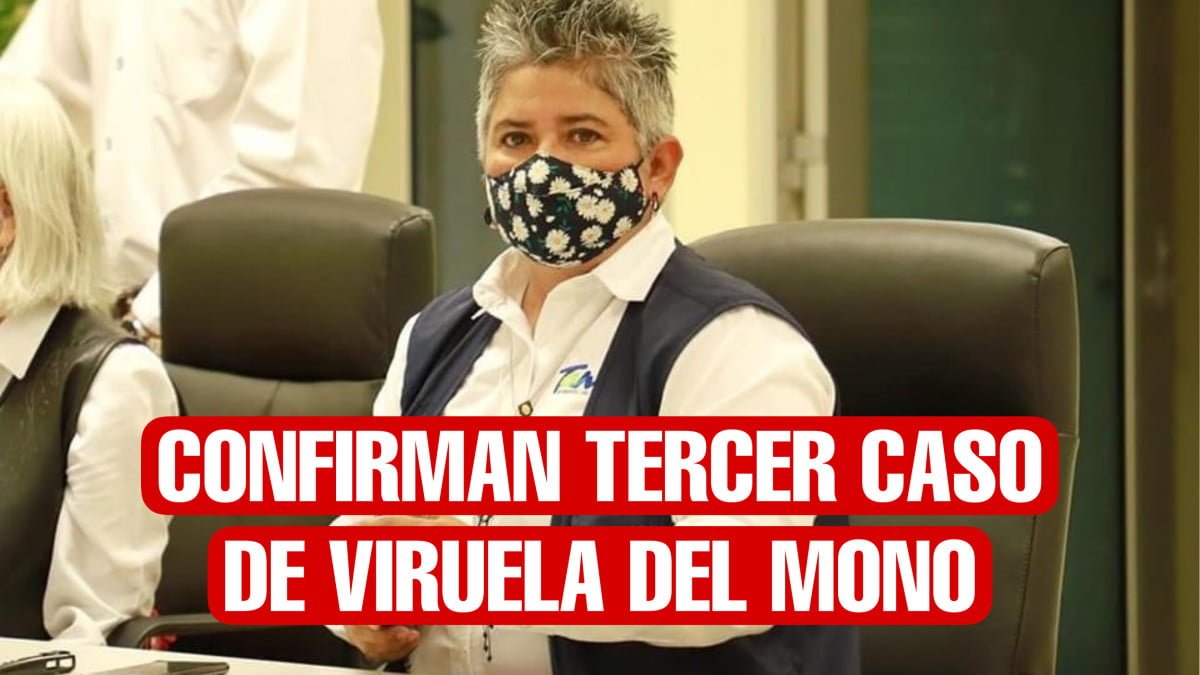 Confirman tercer caso de viruela del mono en Tamaulipas