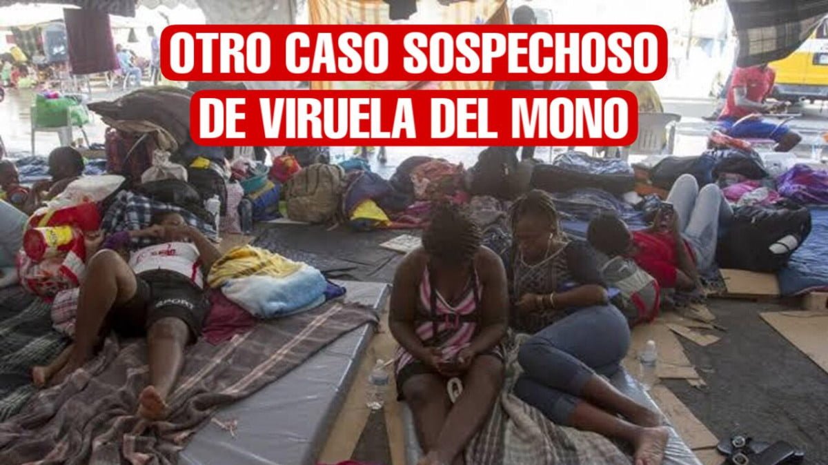 Aíslan a migrante haitiano, sospechan caso viruela del mono