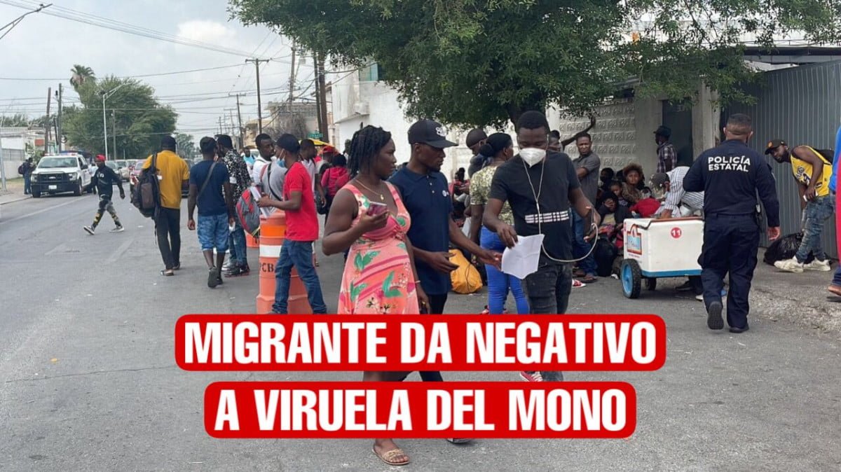 Da negativa prueba de viruela símica en migrante