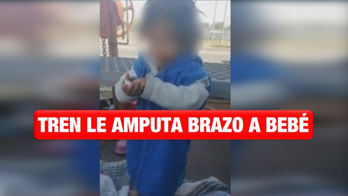 Tren le amputa brazo a bebé