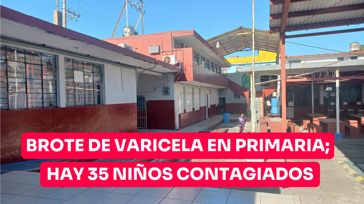 Brote de varicela en primaria de Ciudad Madero