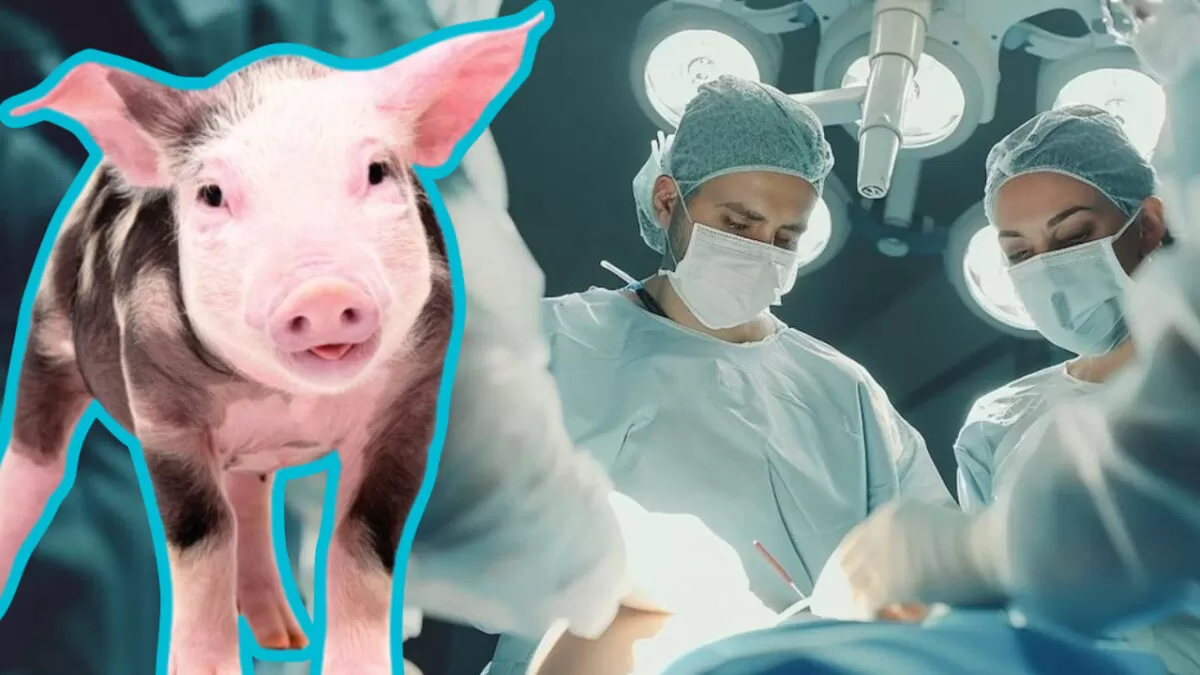 Logran realizar el primer trasplante de hígado de cerdo en humano
