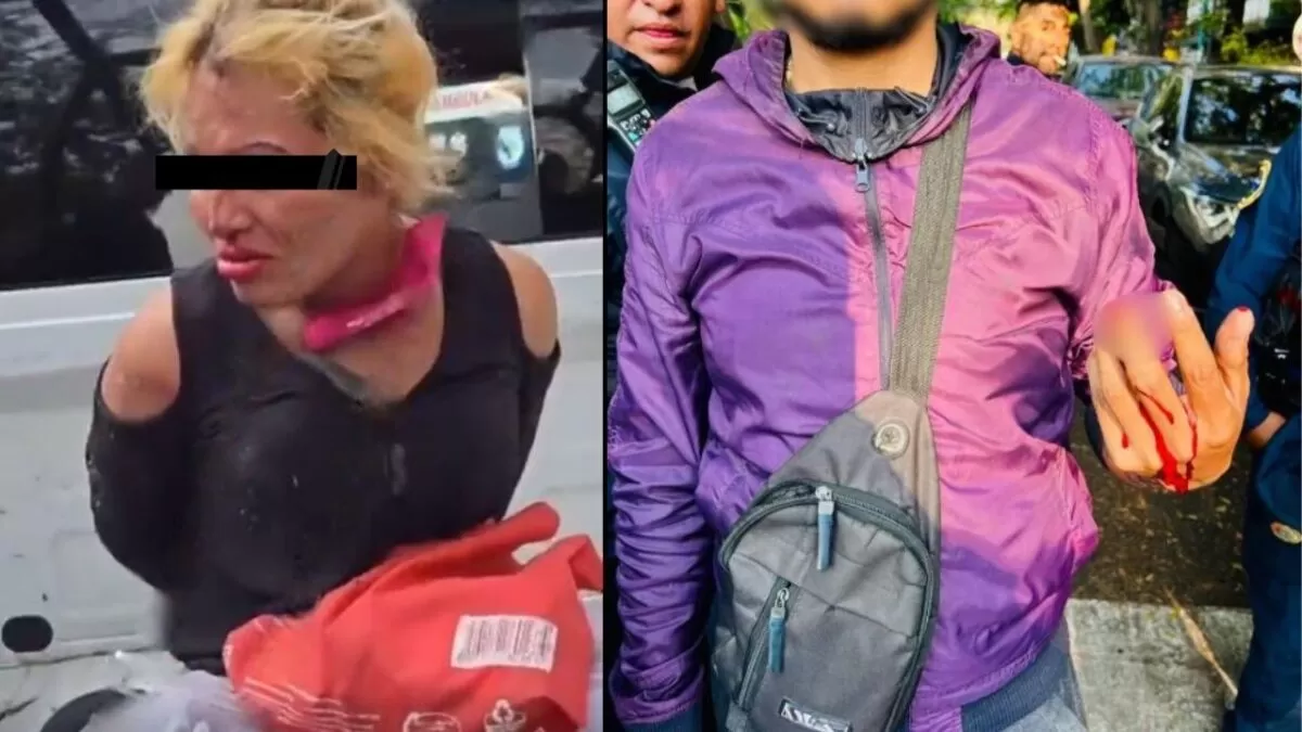 Mujer intenta asaltar a joven y le arranca el dedo a mordidas en CDMX