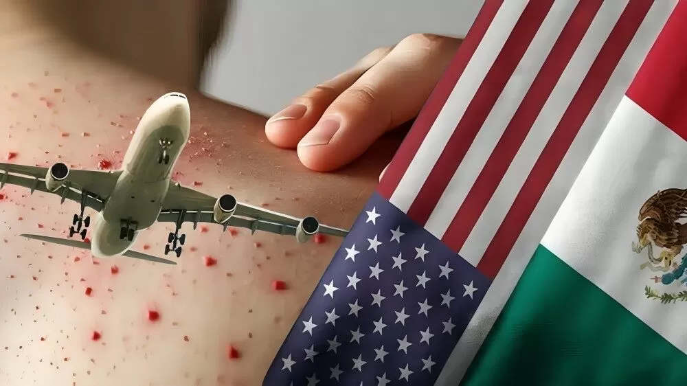 México alerta para no viajar a Estados Unidos y Canadá por brotes de sarampión