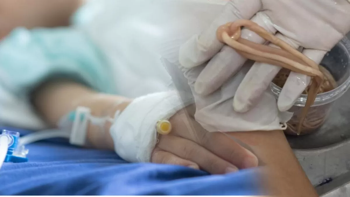 Le extraen 142 lombrices intestinales a niño de 7 años