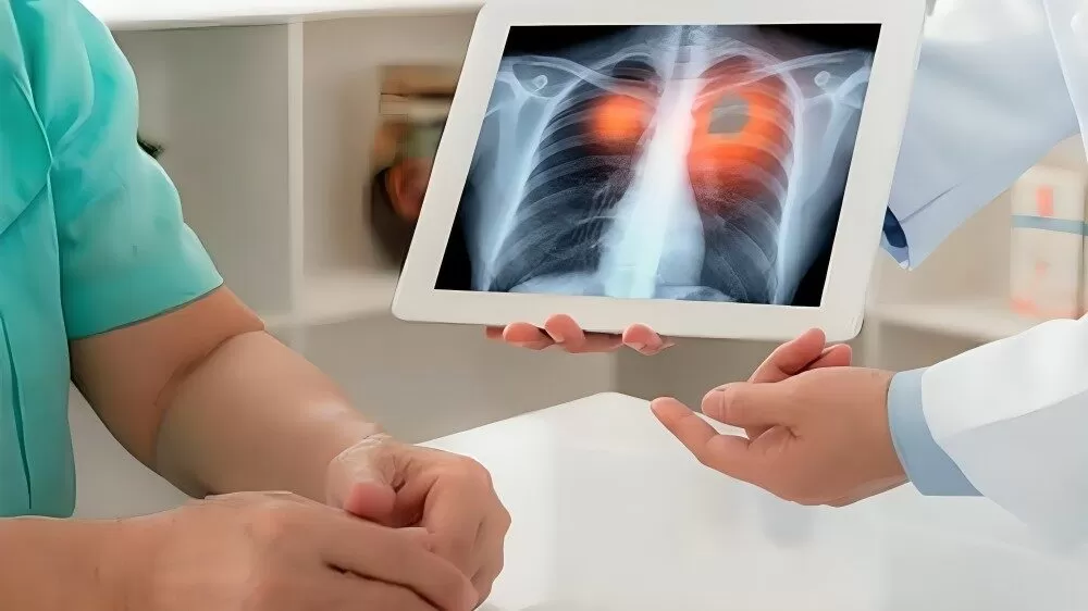 Alertan en Tamaulipas por aumento en casos de cáncer pulmonar
