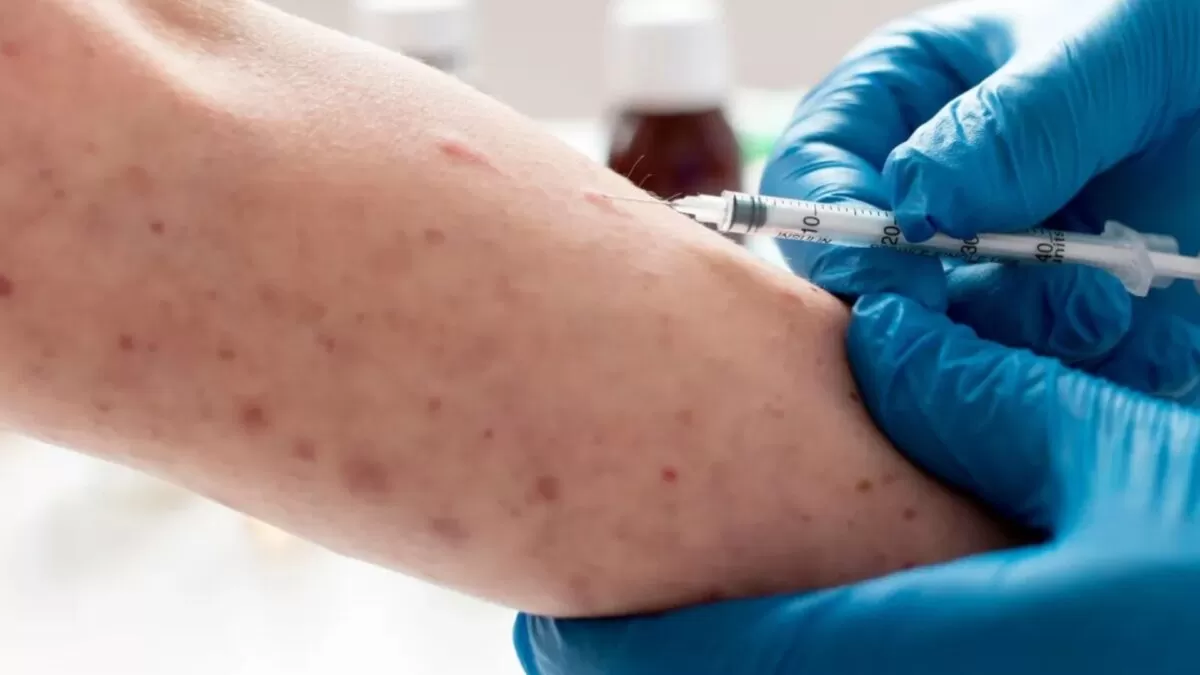 Texas anuncia el fin del brote de sarampión tras más de 700 casos