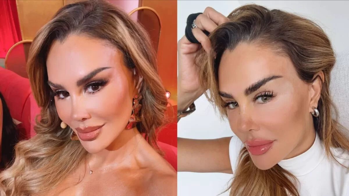 Ninel Conde se somete a costosa cirugía para cambiar el color de sus ojos