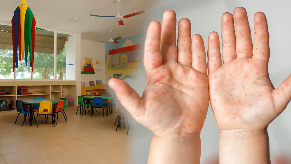 Reportan sólo una escuela con casos de virus manos, pies y boca en Madero