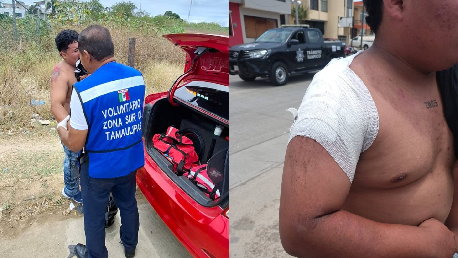 Derrape en moto deja a pareja lesionada en Tampico